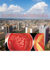 Read more about the article Supergonorrhoea Rocks Nairobi, Kenya.